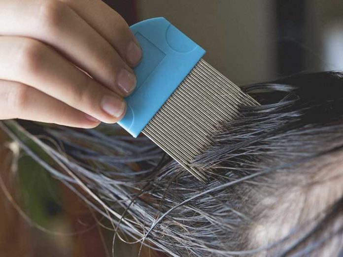 How to remove lice from hair Permanently?