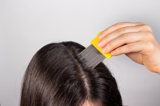 How to remove lice from hair Permanently?